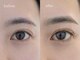 ネストアイ(NEST eye)の写真
