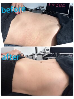 ルシェリアノーブル(le cherien noble)/キャビゼロ20分