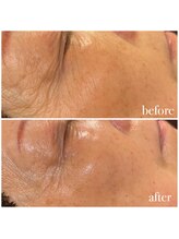 リノベル(LINOBELLE)/乾燥、エイジングケア