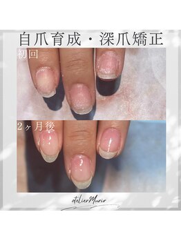 アトリエ ミュリー 代官山(atelier murir)/自爪育成・深爪矯正・巻き爪ケア