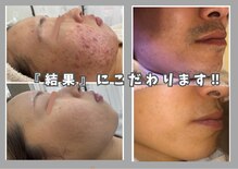 エスプラス エヌプラス(S+/N+)