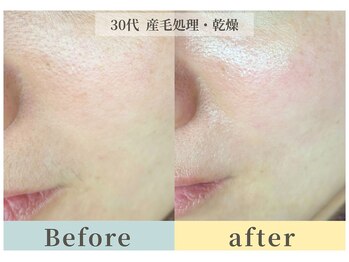 ムク(Muqu.)/ノーファンデさん続出♪