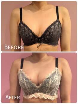 ククナ 上越店(KUKUNA)/20代（１年継続）