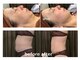美ネージュの写真/都度払いで通いやすい！レモンボトルも全身脱毛も、高額契約なしで好きな時に。金沢の隠れ家サロン
