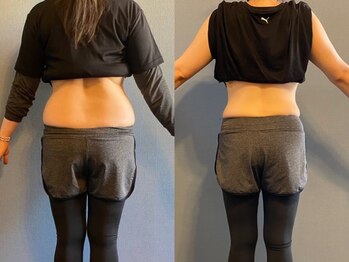 クリアリティ ボディ ケア(clearity body care)/2ヶ月間のビフォーアフター♪