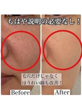 マリアム(mariam)/自分史上最高美肌を更新中！