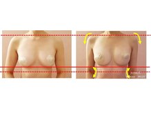 シャルマン(Charmant)/最先端機器のバストケア