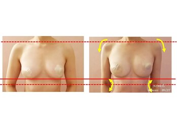 シャルマン(Charmant)/最先端機器のバストケア