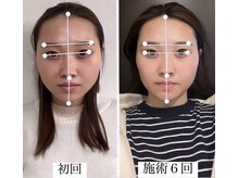 ラボーテヴェリテ(La Beaute Verite)/【お客様施術例】