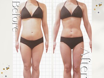 オームの森 北浜/日本特許取得の最新痩身マシン