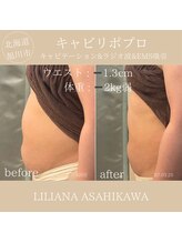 リリアーナ アサヒカワ(LILIANA ASAHIKAWA)/ボディメイク(ウエスト）