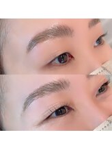 【5】一重・奥二重の施術が得意