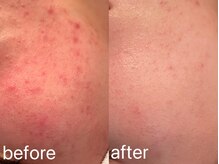 コカオ 銀座サロン(cocao)の雰囲気(実績多数!諦めかけていた方是非!)