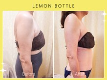 シロカネ 光の森店(SHIROKANE)/レモンボトル☆