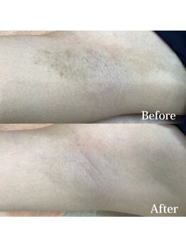 エルヴァ(ELVA)/
