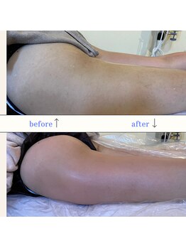 シャイニー(Shiny)/【★愛され美ボディ★】90分