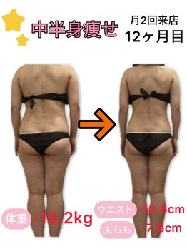 アフリオーラ(affriolant)/ビフォーアフター