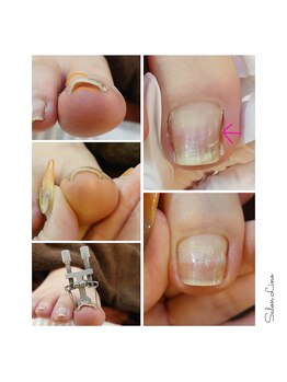 サロン リノ(salon Lino)/痛み解放しませんか