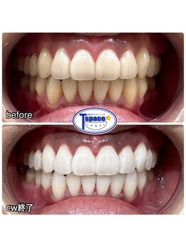 ティースペース(T-space)/クリスタルWhite Plus