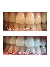 佐賀ホワイトニングラボ/