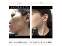 ヨサパーク アクアマリン 日野店(YOSA PARK)/お肌も変わります★