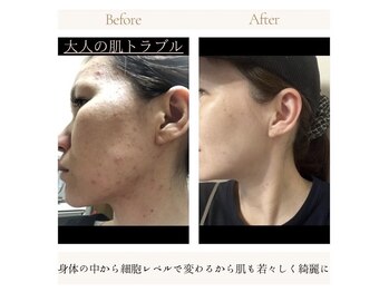 ヨサパーク アクアマリン 日野店(YOSA PARK)/お肌も変わります★