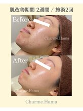 シャルム(Charme.)/オーダーメイドフェイシャル