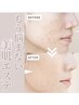 全員/ニキビケア&毛穴開き改善コース+アロマデコルテ※リフトアップ込