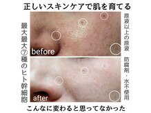 ルオント(LUONTO)/スキンケア症例