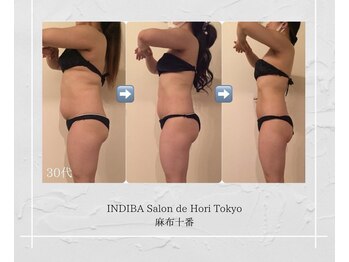 インディバホリトウキョウ(INDIBA HORI TOKYO)/経験豊富なスタッフが在籍