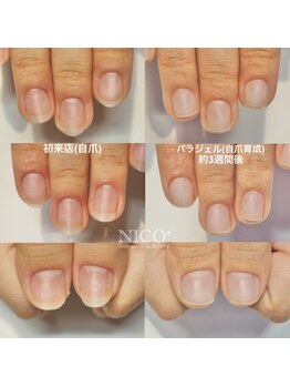 ニコプラス(NICO+)/自爪育成中