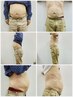 高出力EMSでお腹スッキリ！ウエスト100→93 体重73Kg→69Kg