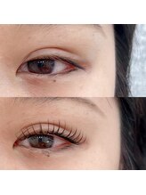 スリール(sourire)/&healthy×100本