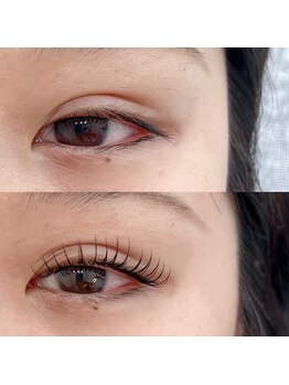 スリール(sourire)/&healthy×100本