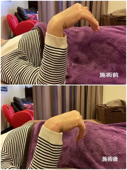 ヴィラ整骨院/手首の痛み改善に◎