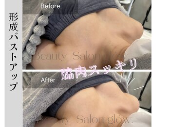 グロウ(glow.)/脇肉スッキリ、立体感