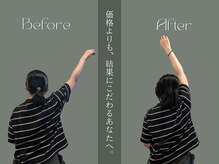 巡 金山店(MEGURI)/肩の痛み