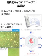 ビアンカ/高精度スコープで無料の肌診断