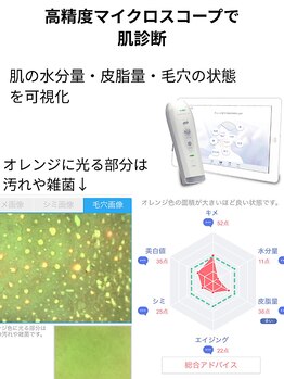 ビアンカ/高精度スコープで無料の肌診断