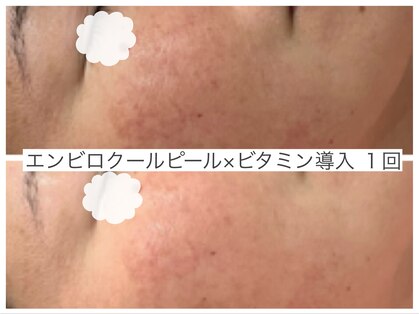 イナファーの写真