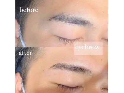 アール(R)の写真