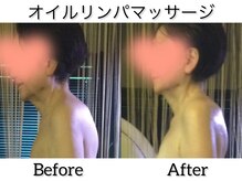 温和活 ロータス(温和活Lotus蓮:)/オイルリンパマッサージ施術変化