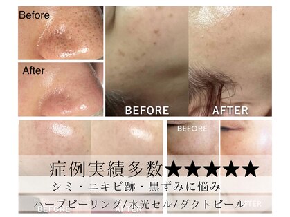 肌屋(HADA-YA)の写真