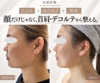 グロウ バイ フェイシャルデザイン アンド アイ(GROW)