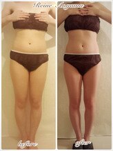 レーヌ青山(Reine Aoyama)/施術★インディバで内臓機能活性