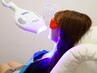 【初回限定】セルフホワイトニング最上位コース15分×3回のLED照射