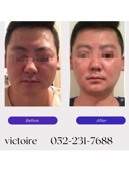 ヴィクトワール(Victoire)/●美容大好きな男性も大歓迎