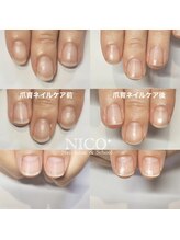 ニコプラス(NICO+)/爪育ネイルケア(ハンド)
