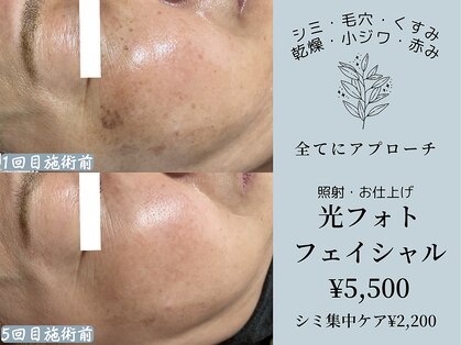 クレアナ ザ ビューティー(KULEANA the beauty)の写真