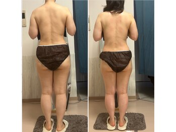 オーシャンブルーム 目黒(OceanBloom)/たったの1回肩こり腰痛